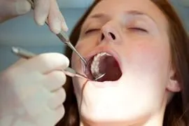 Girl getting teeth cleaned with her mouth opened