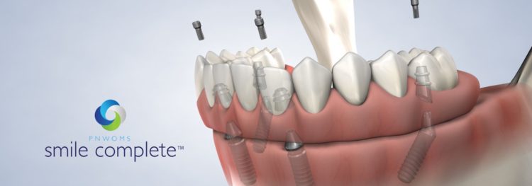 Diagram of lower teeth