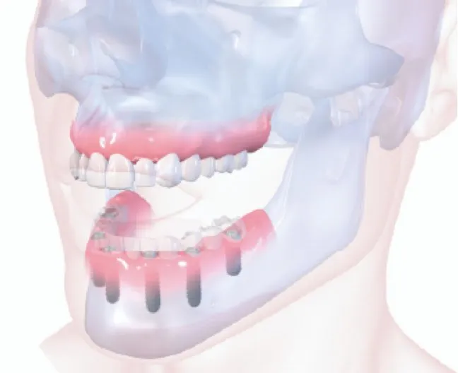 Image of a full mouth in a 3d diagram